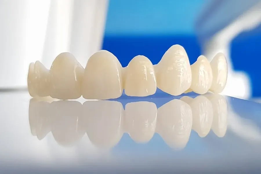 Zirkonkrone oder Keramik-Veneer?